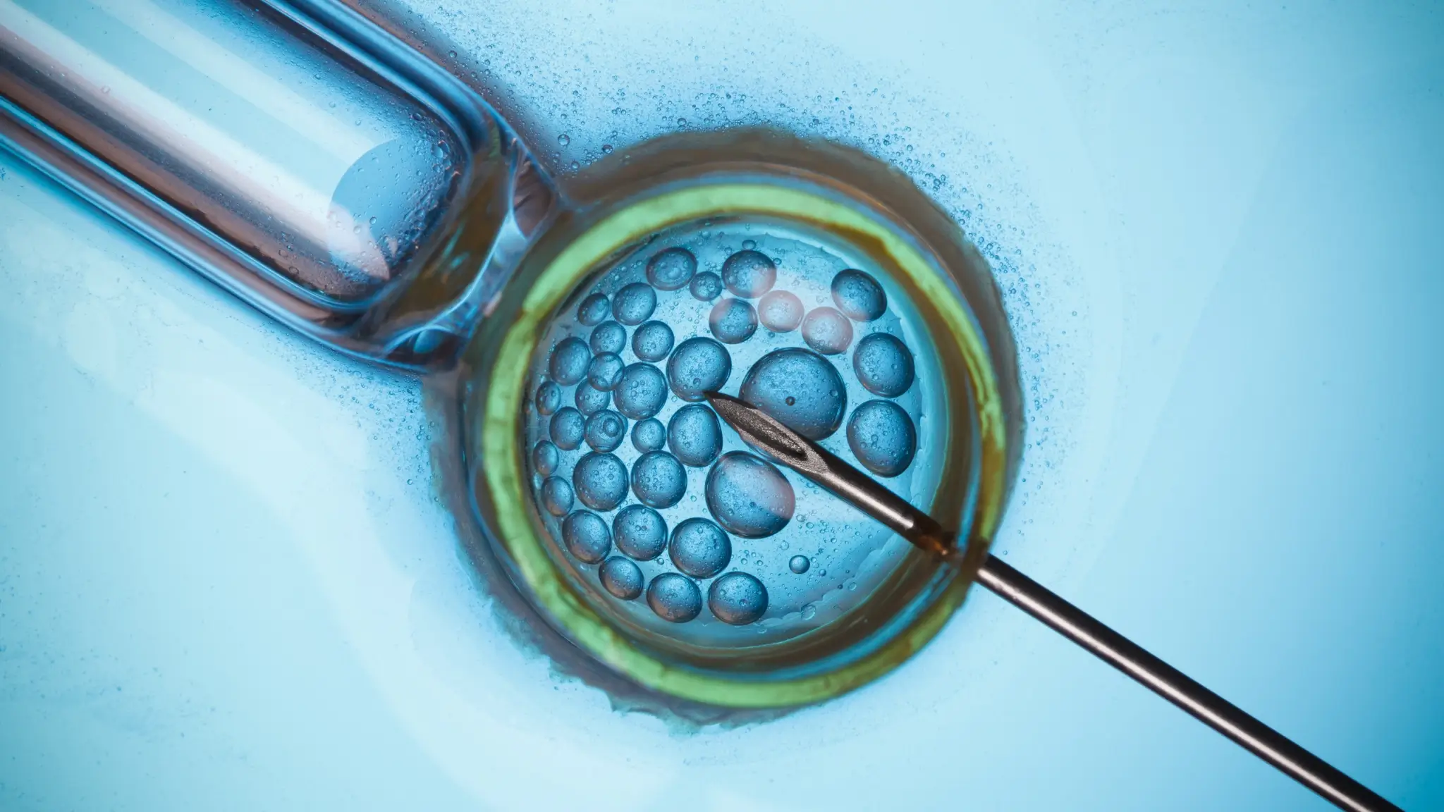 A second opinion fertility consultation can guide your next steps after failed IVF cycles.