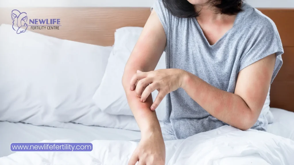 Managing allergic reactions linked to in vitro fertilization medications.