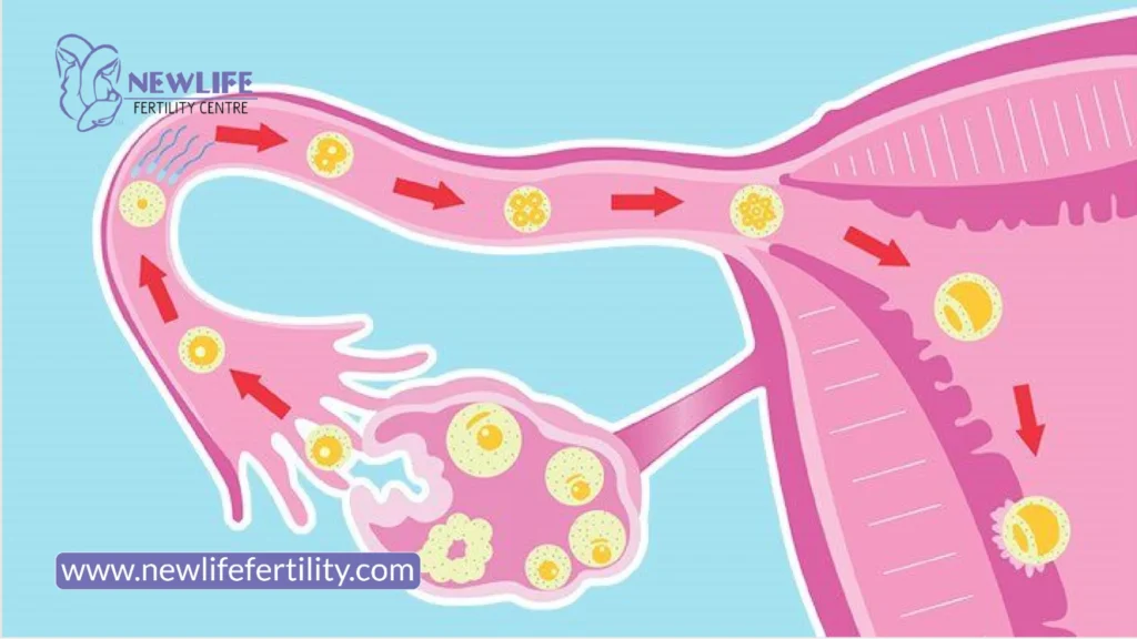 Recovery may involve common estrace ivf side effects.