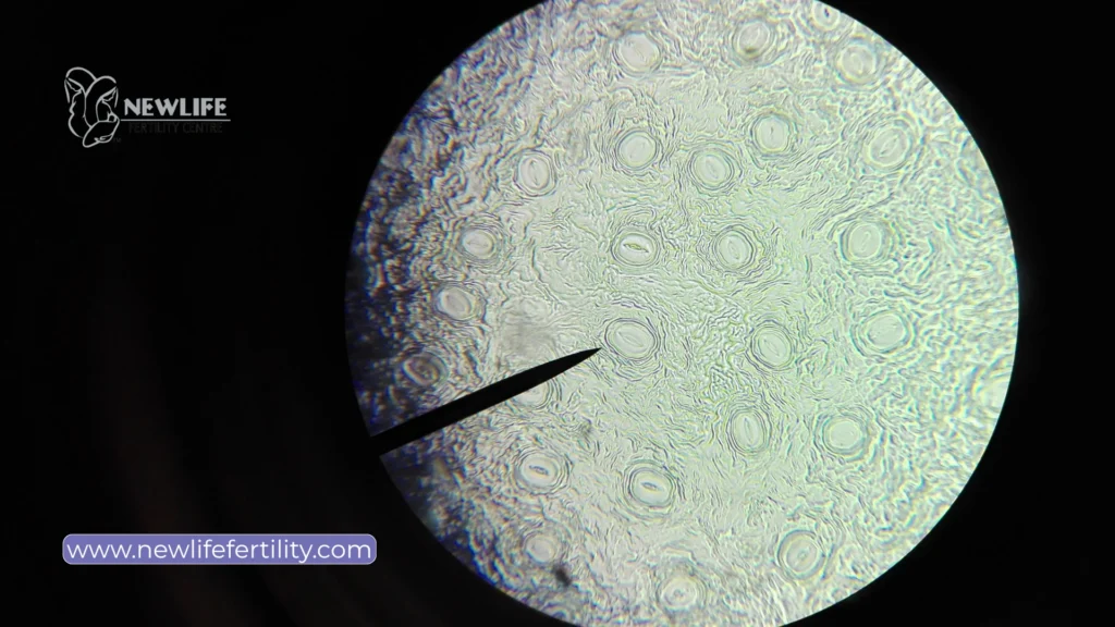 Fresh vs frozen embryo transfer improves fertility treatment outcomes.