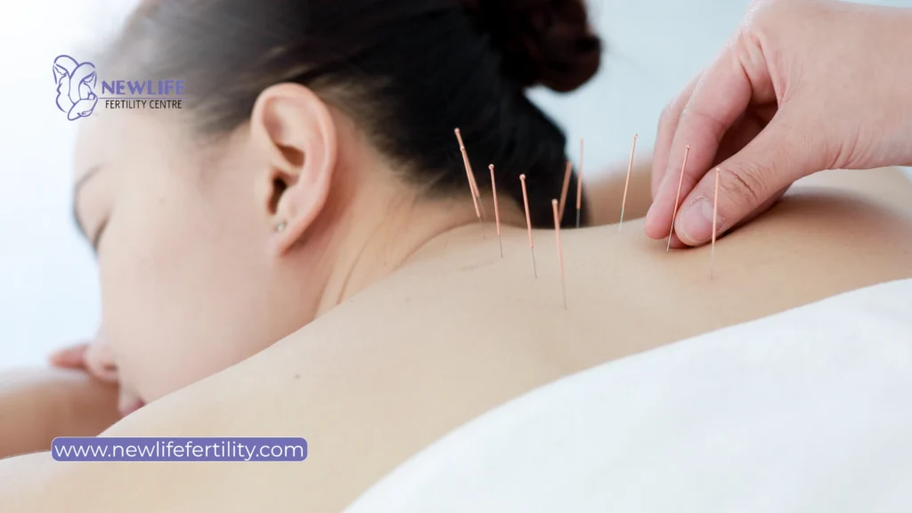 Acupuncture and frozen embryo transfer support healthy blood flow.