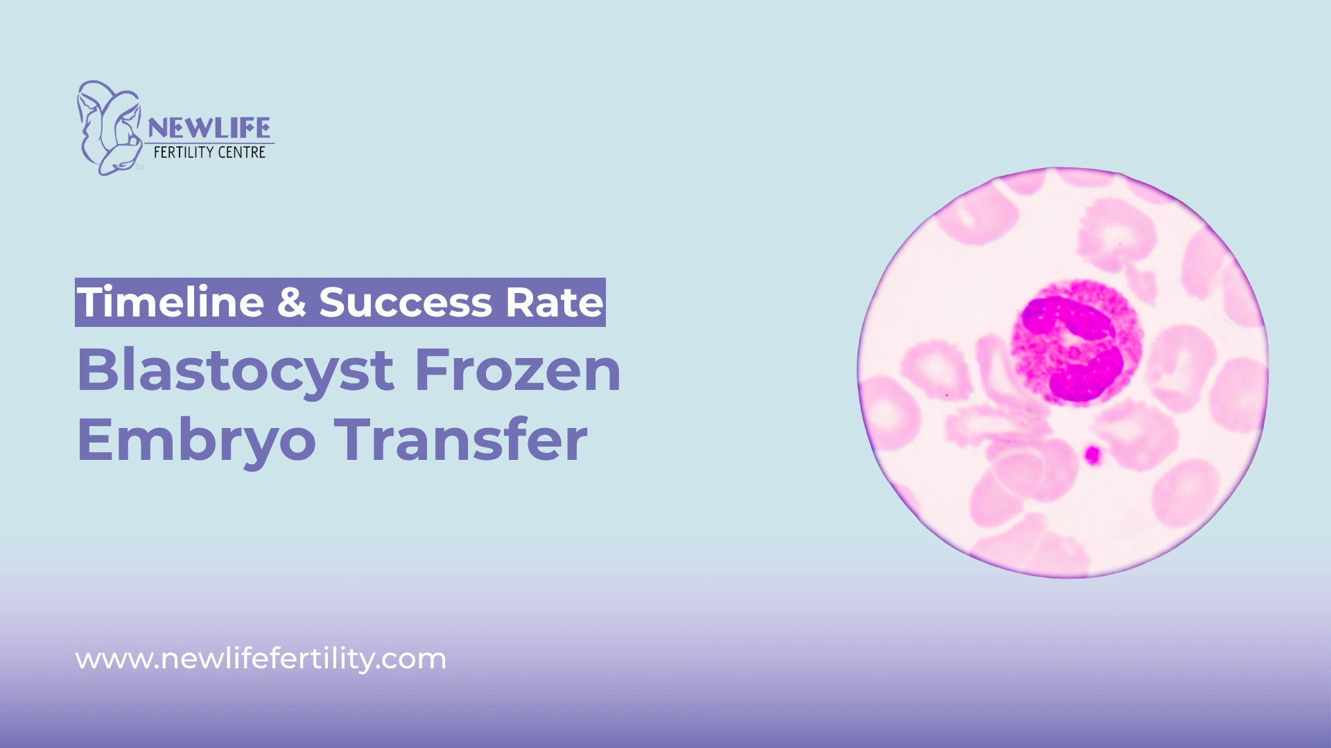 Blastocyst frozen embryo transfer success rate depends on timing and care.