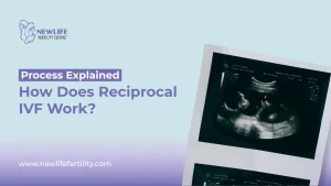 Guide on how does reciprocal IVF work.