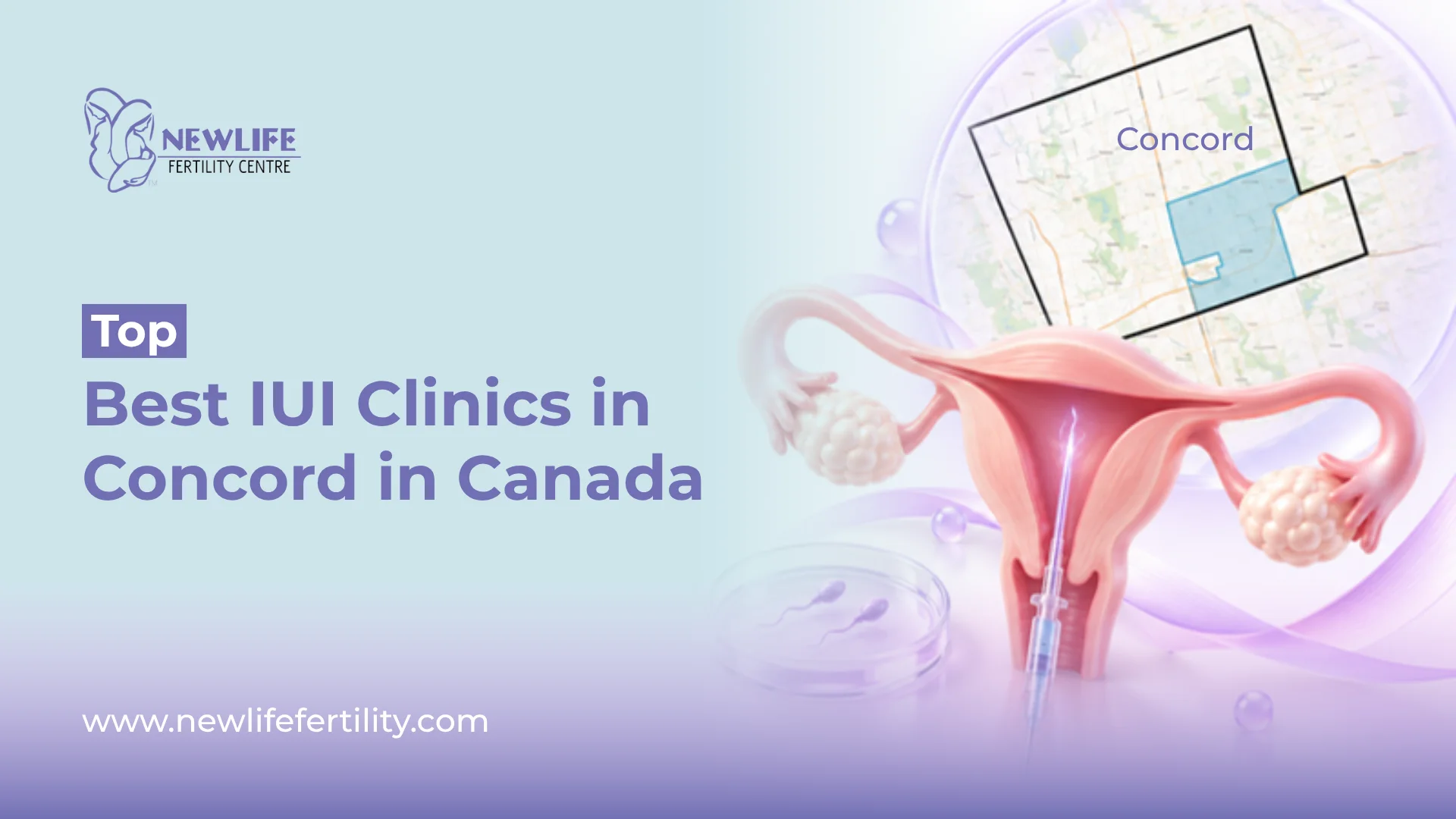 IUI clinics in Concord support patients seeking trusted treatment.