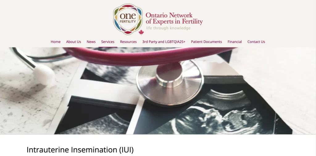 ONE Fertility is among the names patients may research for Milton IUI clinic. 